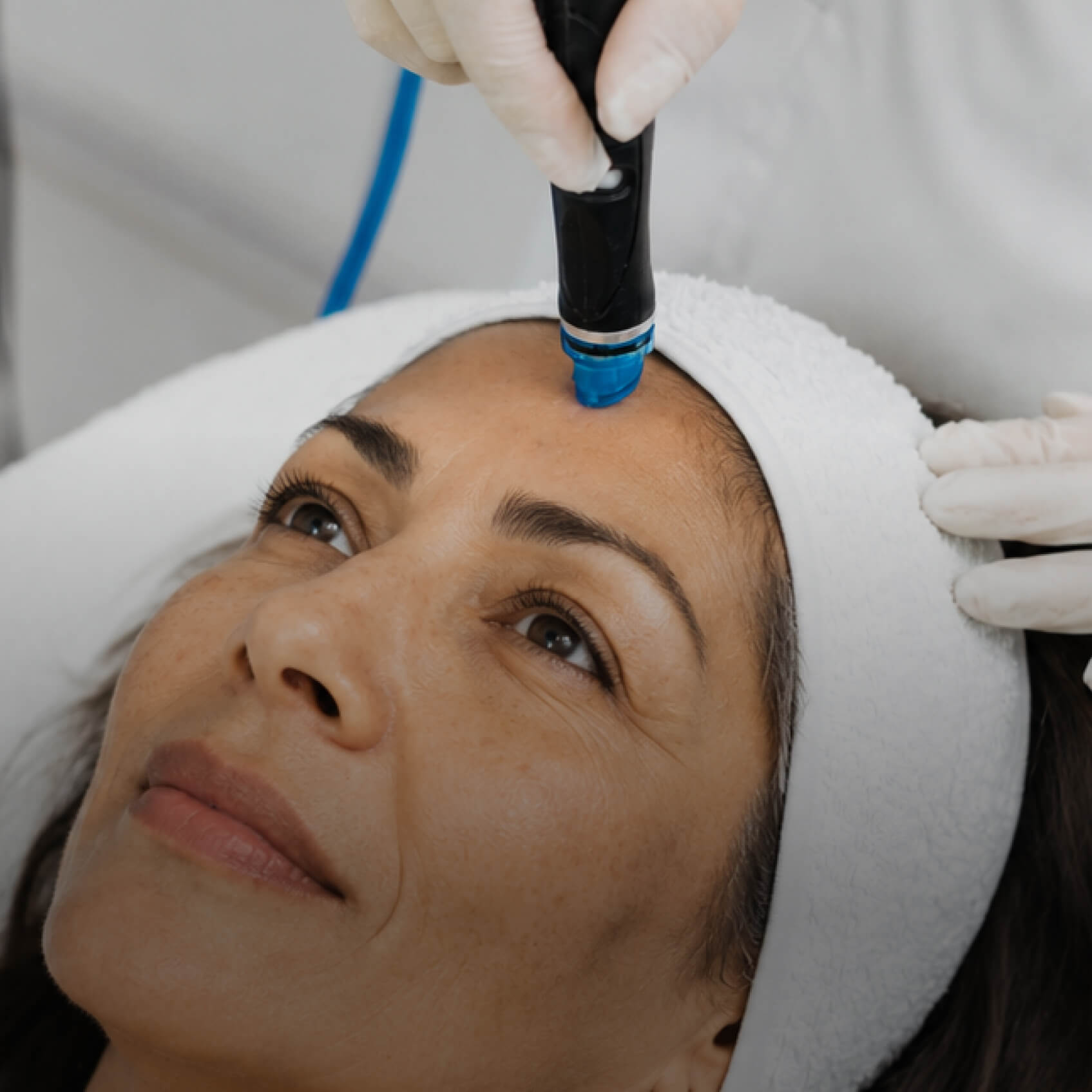 Hydrafacial